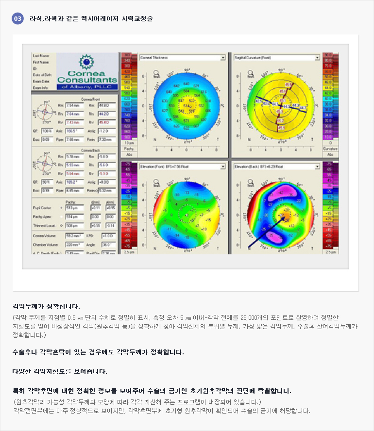 라식, 라섹과 같은 엑시머레이저 시력교정술. 1) 각막두께가 정확합니다. 2) 수술후나 각막혼탁이 있는 경우에도 각막두께가 정확합니다. 3) 다양한 각막지형도를 보여줍니다. 4) 특히 각막후면에 대한 정확한 정보를 보여주어 수술의 금기인 초기원추각막의 진단에 탁월합니다. (첨부) 검사결과 이미지