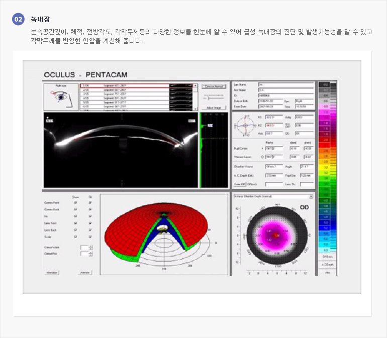 녹내장, 눈속공간깊이, 체적, 전방각도, 각막두께등의 다양한 정보를 한눈에 알 수 있어 급성 녹내장의진단 및 발생가능성을 알 수 있고, 각막두께를 반영한 안압을 계산해줍니다. (첨부) 검사결과 이미지